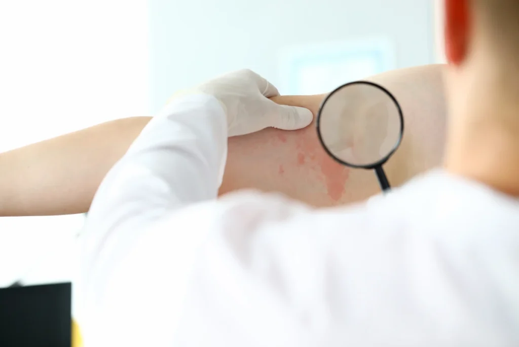 Dermatolog Katowice