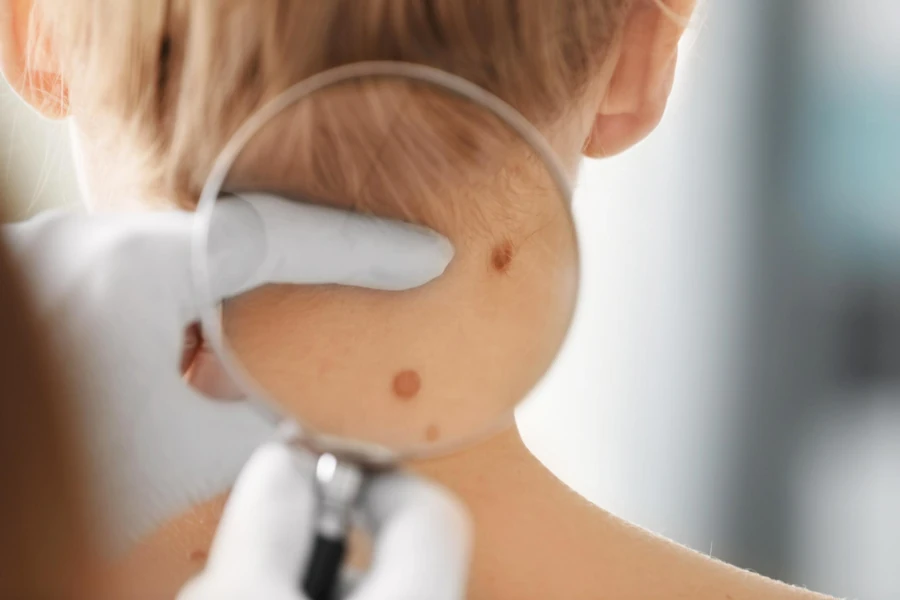 Dermatolog dziecięcy Katowice